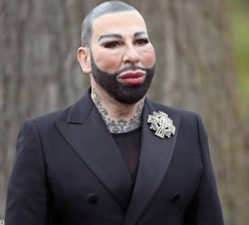 عمل جراحی مردی زن نما | عکس عجیب یک مرد با 70 نوع عمل زیبایی