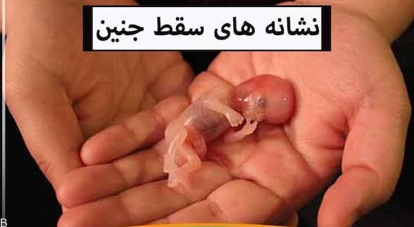 پیدا شدن نوزاد سقط شده در سطل زباله تهران (+عکس)