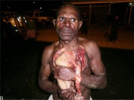 پدری که فرزندش را درسته خورد!!! «+عکس ترسناک»