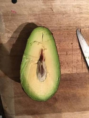 عمل زیبایی واژن برای باکره ها